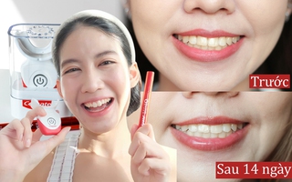 Đánh giá bộ làm trắng răng tại nhà: Dễ sử dụng nhưng vẫn có điểm trừ nhẹ