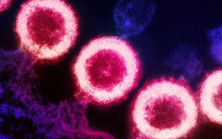 Thông tin thêm về người phụ nữ đầu tiên được ghép tế bào gốc chữa khỏi HIV