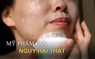 5 hệ luỵ đáng sợ khi dùng mỹ phẩm kém chất lượng, BS da liễu đưa ra lời khuyên quan trọng