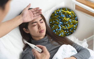 Mức độ nguy hiểm của bệnh Marburg và các triệu chứng dễ bị nhầm lẫn cần đặc biệt lưu ý