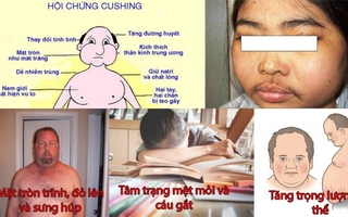 Nguy hiểm khôn lường nếu tự ý sử dụng corticoid