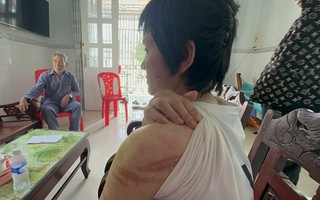Người chồng bị tố bạo hành vợ bầu 7 tháng như thời trung cổ khai gì?