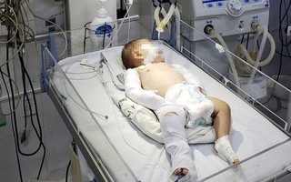 Tạm giữ nghi phạm bạo hành bé gái 3 tháng tuổi đến chấn thương sọ não, gãy xương tứ chi