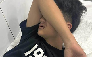 Nam sinh bị đánh gãy răng khi tắm biển ở Đà Nẵng