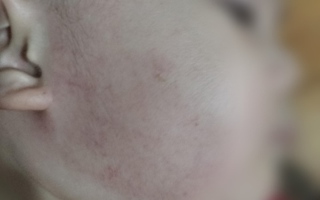 Phẫn nộ cô giáo mầm non tát bé trai 31 cái trong lúc ăn