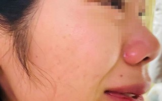 Làm rõ thông tin 1 thầy giáo đánh nữ đồng nghiệp