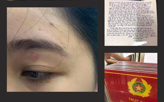 Hai nhân viên bánh mì Nguyên Sinh bị phạt 13 triệu đồng vì hành hung khách