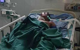 Người đàn ông nguy kịch vì ong vò vẽ đốt