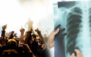 Thanh niên vỡ phế nang vì la hét trong concert của thần tượng: Nguyên nhân nào dẫn đến tràn khí màng phổi?