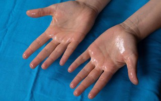 Mùa hè, cơ thể ra nhiều mồ hôi có phải là thải độc tốt hơn hay không?