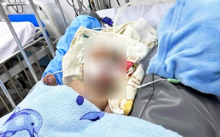 Bé trai 3 tháng tuổi tử vong nghi bị bạo hành: Bệnh viện Nhi Đồng 2 thông tin