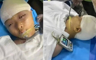 Vụ nữ sinh bị "tác động vật lý" đến mức vỡ hộp sọ: Quá khứ của thầy giáo bị vạch trần