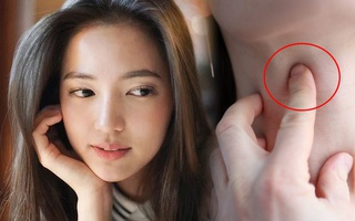 Thời điểm phụ nữ có nguy cơ mắc K tuyến giáp cao nhất trong đời, BS khuyên nên thận trọng tầm soát