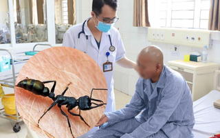 Bị kiến cắn, người đàn ông sốc phản vệ mức độ nguy kịch