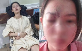 Thiếu nữ 17 tuổi mù mắt vĩnh viễn, liệt nửa não trái sau tiêm filler nâng mũi: Đừng quên 4 điều để an toàn khi làm đẹp