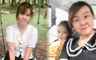 Sau 20 lần mổ, cô gái bị chồng đổ xăng đốt hôm mùng 2 Tết hiện ra sao?
