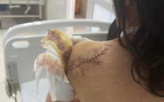 Công an bảo vệ người phụ nữ kêu cứu vì 2 lần bị truy sát