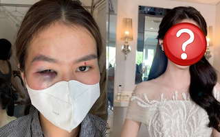 Vụ đi trang điểm đám cưới, thợ makeup tố bị em gái cô dâu "tương tác" bầm tím mắt: hai bên nói gì?