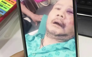 Ca sĩ Tô Thanh Phương nằm viện, tiết lộ lý do nhảy lầu: "Tôi bị sốc, sợ bị mù"