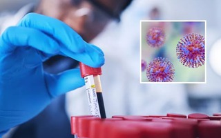 Australia thất lạc hơn 300 ống chứa virus nguy hiểm chết người