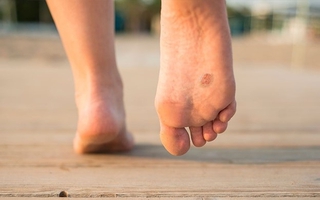 6 thay đổi trên chân ngỡ bình thường lại là dấu hiệu của ung thư ít người biết