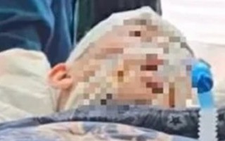 Nam sinh lớp 8 bị đánh đến chết não khi chơi bóng rổ: Cục Trẻ em lên tiếng