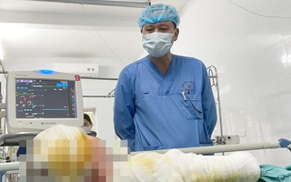 Hơn 2 tháng giành giật mạng sống cho nam thanh niên bỏng 'thập tử nhất sinh'