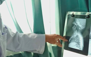 Chiếc kim băng dài hơn 3cm trong thực quản bé trai