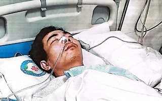 Sắp xét xử đối tượng đánh hàng xóm chấn động não, có tính chất côn đồ ở Hưng Yên