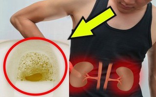 Sau tuổi 60, nếu có 4 triệu chứng này khi đi tiểu chứng tỏ bạn dễ mắc bệnh thận, tuổi thọ ngắn