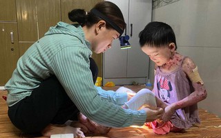 Hơn 102 triệu đồng đến với bé gái 8 tuổi toàn thân lở loét, tứa máu vì căn bệnh quái ác