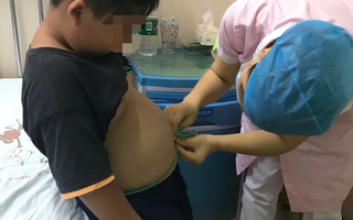 Bé trai 10 tuổi gan nhiễm mỡ "trắng bệch" vì 3 món nhiều trẻ thích mê