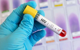 Nhiễm HIV không phải dấu chấm hết, có 6 việc bạn cần làm để mở ra “chương mới” cuộc đời