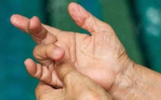 4 thay đổi ở ngón tay có thể là dấu hiệu ung thư phổi, hãy đi khám ngay!
