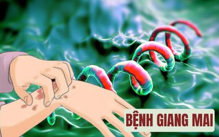 Infographic: Bệnh giang mai "âm thầm" lây lan: Bạn đã biết cách bảo vệ mình?