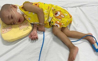Mẹ nghèo xin sữa để duy trì sự sống cho con gái 3 tuổi mắc bệnh quái ác