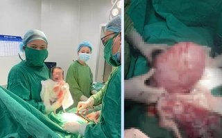 Xử lý thành công khối u xơ tử cung nặng 1,6kg và đón bé trai chào đời