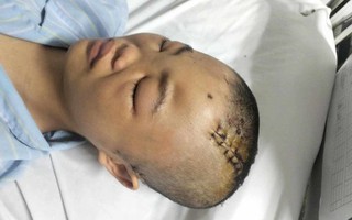 Mẹ suy thận giai đoạn cuối cầu xin sự sống cho con gái nguy kịch vì tai nạn giao thông