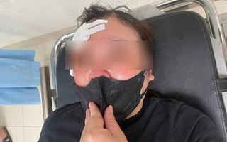 Hà Nội: Người phụ nữ tố bị tài xế ô tô dùng dùi cui đập chảy máu đầu khi đang nghe điện thoại, chưa thể tránh đường