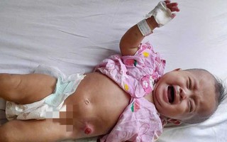 Ánh mắt cầu cứu của bé gái 6 tháng tuổi bị dị tật bẩm sinh, không tiền cứu chữa