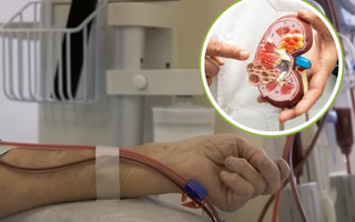 Người trẻ bị suy thận ngày càng cao: “Nằm lòng” 3 lời khuyên từ bác sĩ để dự phòng sớm căn bệnh này!