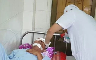 Cánh quạt máy bay không người lái chém gãy xương mũi người đi đường