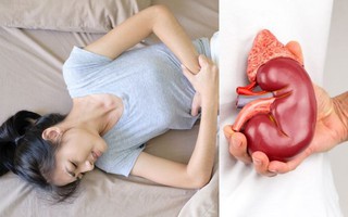 Cô gái trẻ 18 tuổi đã bị “hỏng” thận vì 3 kiểu ăn uống thường gặp ở người trẻ: BS khuyên làm ngay 4 việc để để bảo vệ "nhà máy lọc máu" của cơ thể