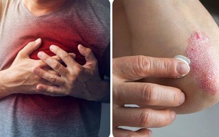 8 dấu hiệu cảnh báo thận không khoẻ