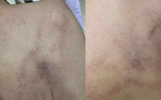 'Giáo viên hay kẻ ác nhân mà đánh trẻ không biết ghê tay'
