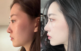 Làm đẹp an toàn: Đừng đánh đổi nhan sắc bằng những sai lầm