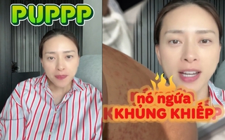 Mẹ bầu Ngô Thanh Vân gặp một tình trạng "vô cùng khó chịu" trong thai kỳ: Ngứa khủng khiếp nhưng vẫn thấy mừng vì 1 điều