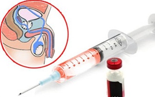 Thêm một số nước “thiến” tội phạm tình dục