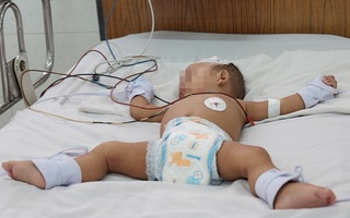 TP.HCM: Mẹ cho tắm liền sau khi bú no, bé gái 20 ngày tuổi sặc sữa ngưng thở