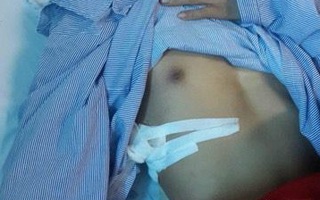 Đưa cô gái bị tai nạn giao thông đi cấp cứu, người đàn ông bị đánh nhập viện